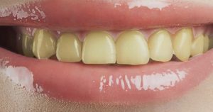 9 vấn đề về răng miệng thường gặp nhất