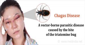 Bệnh Chagas (Trypanosoma châu Mỹ)