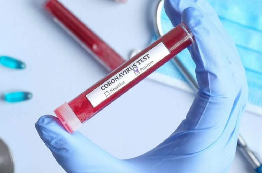 Trung Quốc sắp thử nghiệm vaccine ngừa virus COVID-19